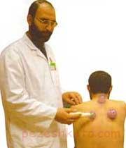 برای چه بیماریهایی حجامت کنیم