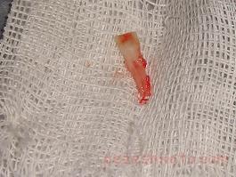 dandane-keshide-shode