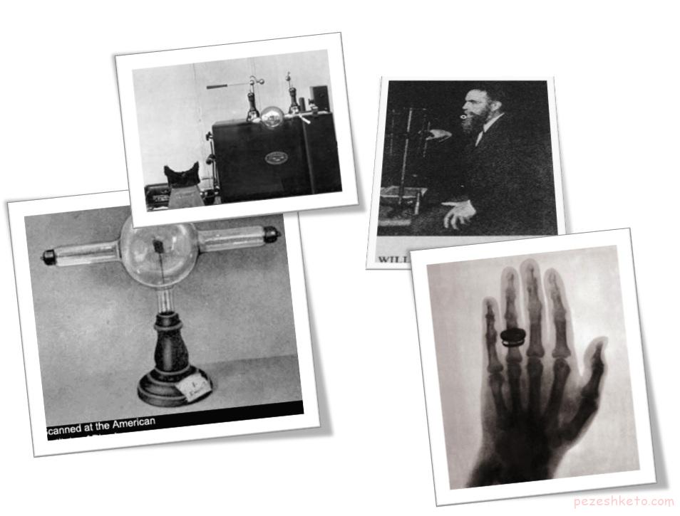 معرفی اشعه ایکس