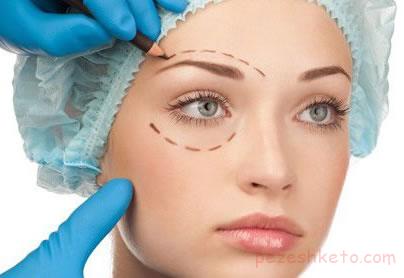 جراحی های زیبایی در ناحیه چشم