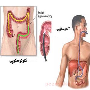 علائم خونریزی گوارشی چیست