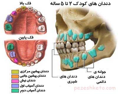 رشد دندان دائمی قبل از افتادن دندان شیری