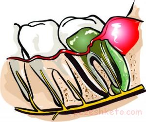 اطلاعاتی درباره لق شدن دندان