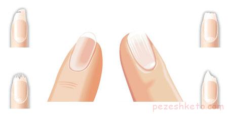 عوامل موثر در رشد ناخن کدامند