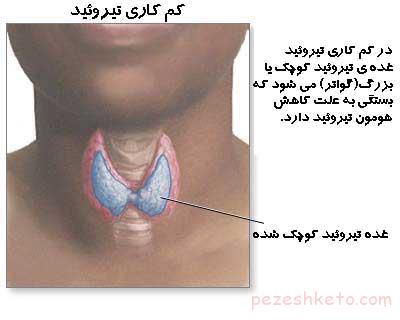 علائم پوستی اختلالات تیروئید
