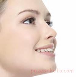 همه چیز درباره جراحی بینی عروسکی