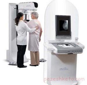 ماموگرافی چیست؟