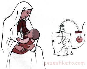 چه زمانی شیر مادر باید دوشیده شود