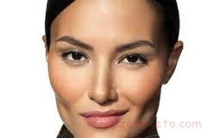 پروتز گونه چیست