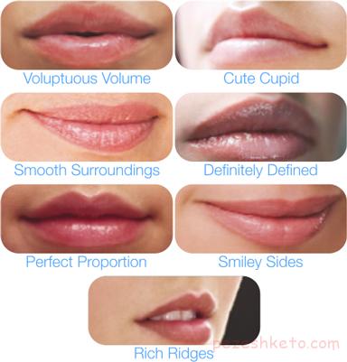 پروتز لب و انواع روش های پروتز لب