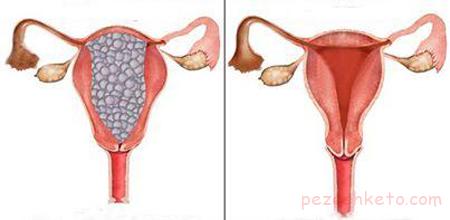 مول هیداتیدیفورم
