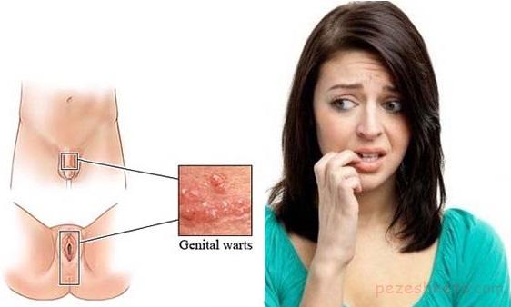 بیماریهای پوستی ناحیه تناسلی