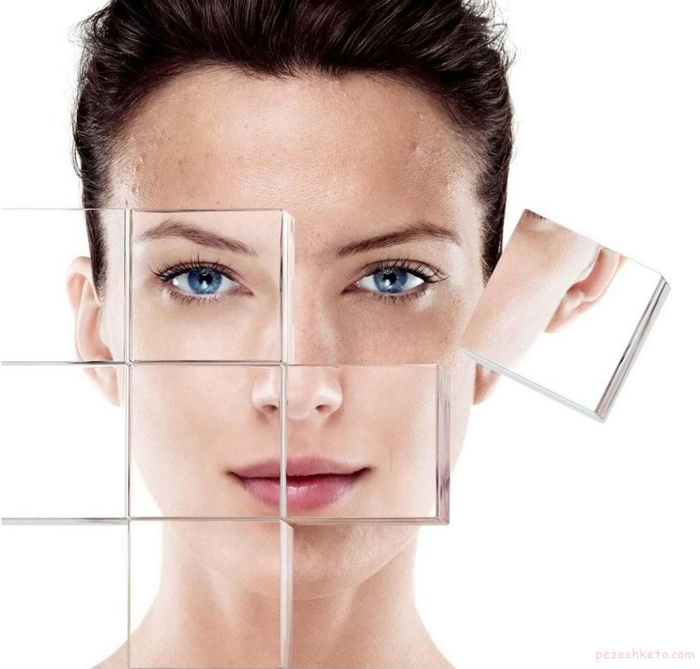 كراتوزاكتينيک چیست