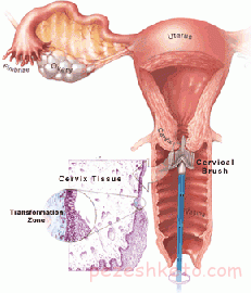 تست پاپ اسمیر قبل از بارداری