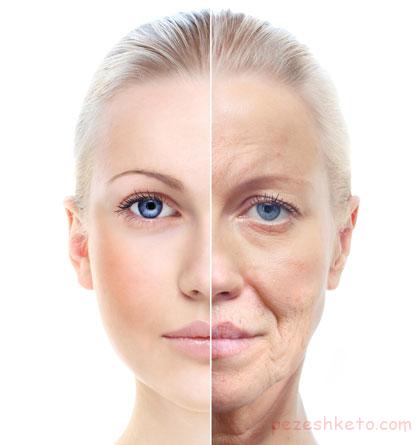 افتادگی پوست بعد از یائسگی