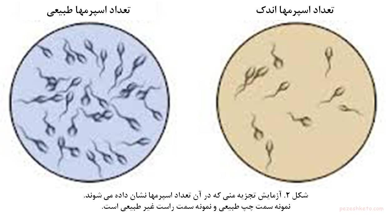 آزمایش نطفه چیست
