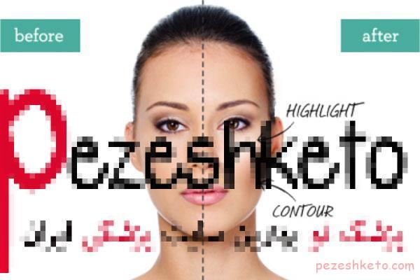 روش های چاقی صورت