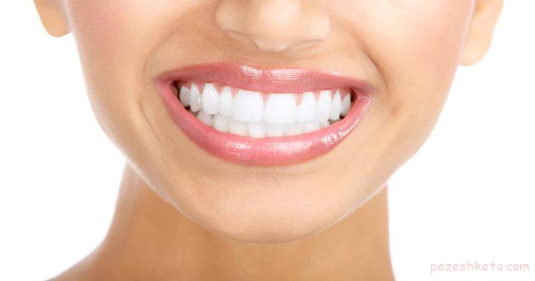 سفید کردن دندان با مواد غذایی و خوراکی ها