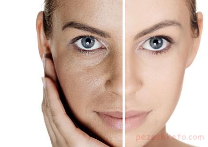 PRP چگونه انجام می شود