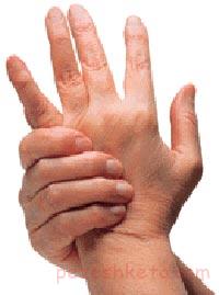 همه چیز درباره اگزما