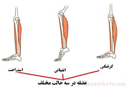 پیشگیری از گرفتگی عضلات پا