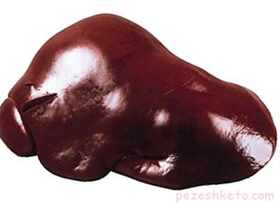 مواردی که موجب کم خونی می شوند