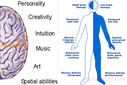 آسیب نیمکره راست مغز