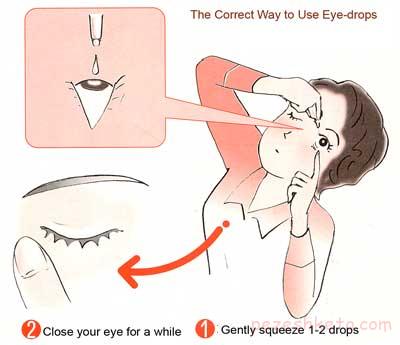 مقاله درباره آلرژی های چشمی