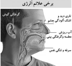 نکاتی برای غلبه بر آلرژی