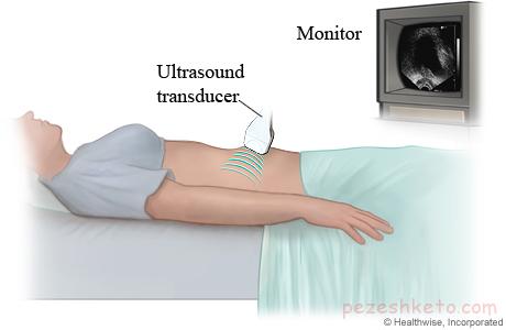 آمادگی پیش از سونوگرافی