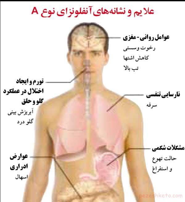 مقاله درباره آنفولانزای خوکی