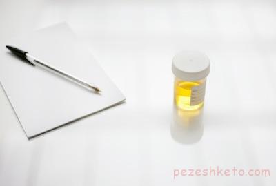 ارتباط رنگ ادرار با تغذیه