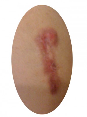 كلوئيد چيست