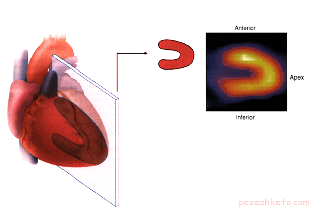 اسکن قلب چیست