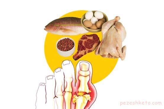 دلایل بالا رفتن اسیداوریک خون