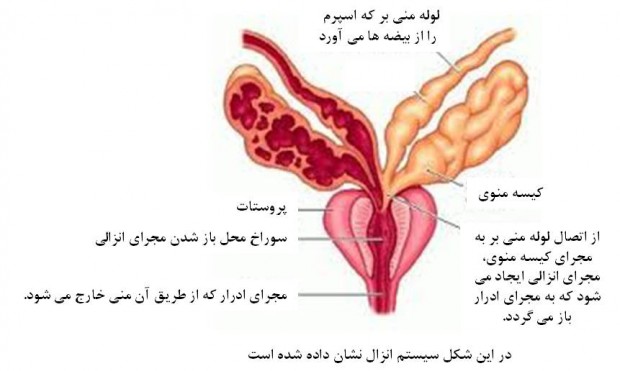 علل ناباروری مردان
