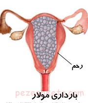 بارداری پوچ