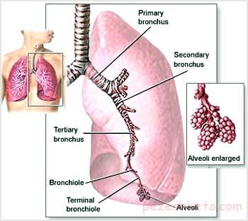 برونشكتازی چیست