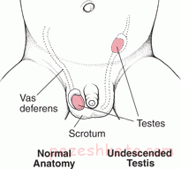 بیضه نزول نکرده