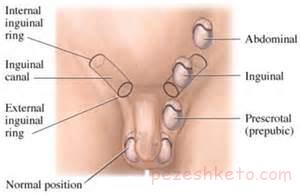 بیضه پایین نیامده