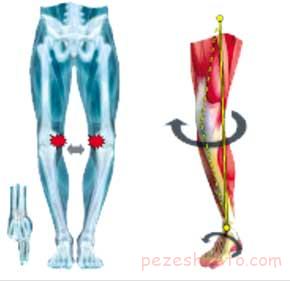 بیماریهای مادرزادی حرکتی
