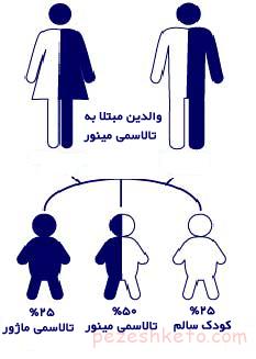 تالاسمی ماژور چیست
