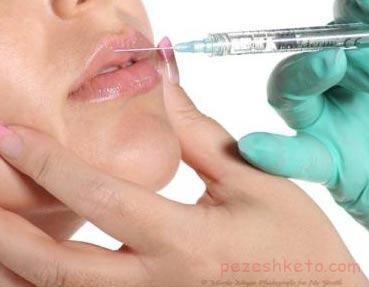 توصیه هایی برای بزرگ کردن لبها