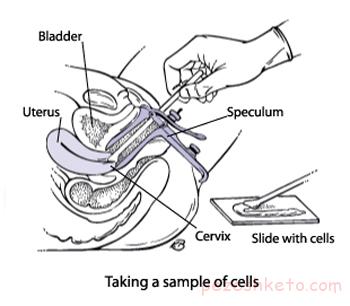 تست پاپ اسمیر