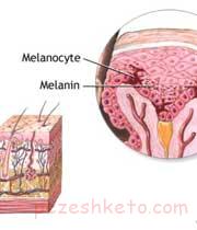 علل تغییر رنگ پوست چیست