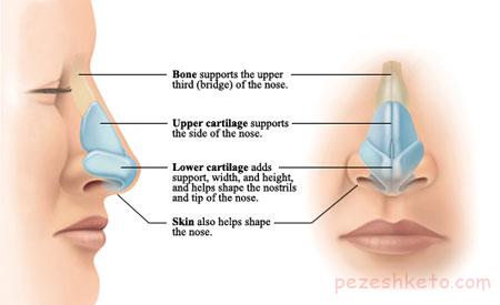جراحی بینی برای چه کسانی مناسب است