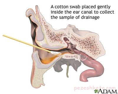نکاتی درباره جرم گوش