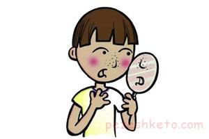 از بین بردن دانه های سرسیاه بینی