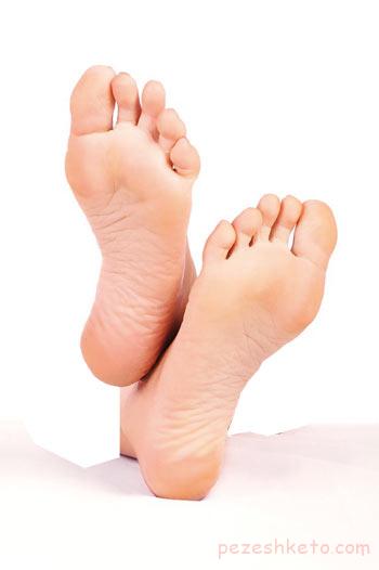 علل خارش پاشنه پا و درمان آن