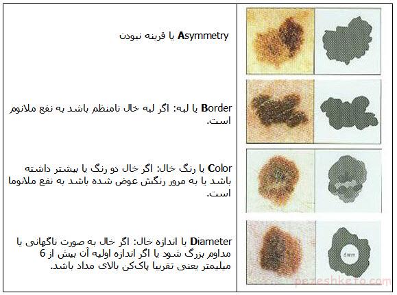 چه خال هایی باید برداشته شوند
